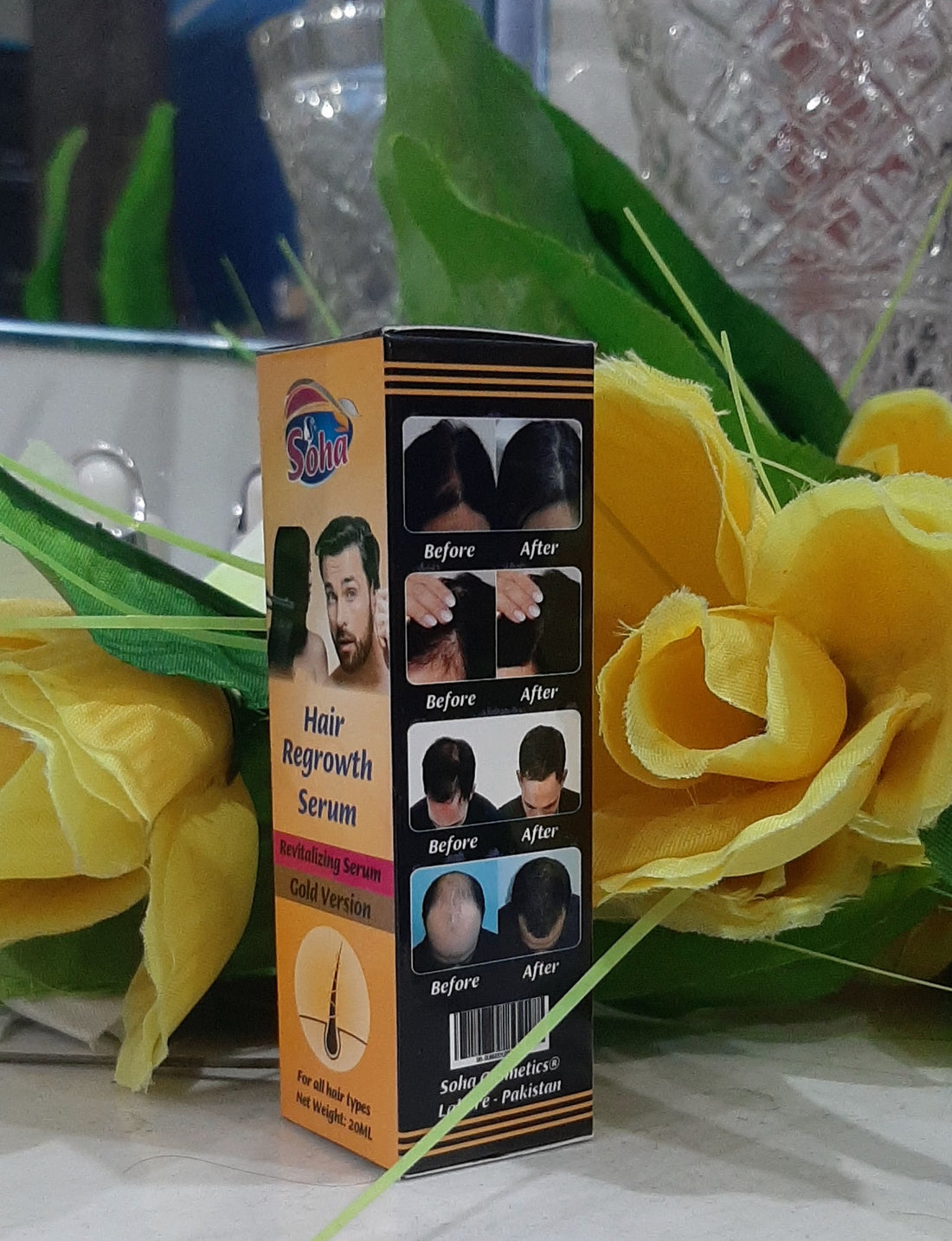 Revitalize Your Hair with Soha Cosmetics Hair Regrowth Serum Gold: The Ultimate Solution for Hair Loss and Thinning Hair